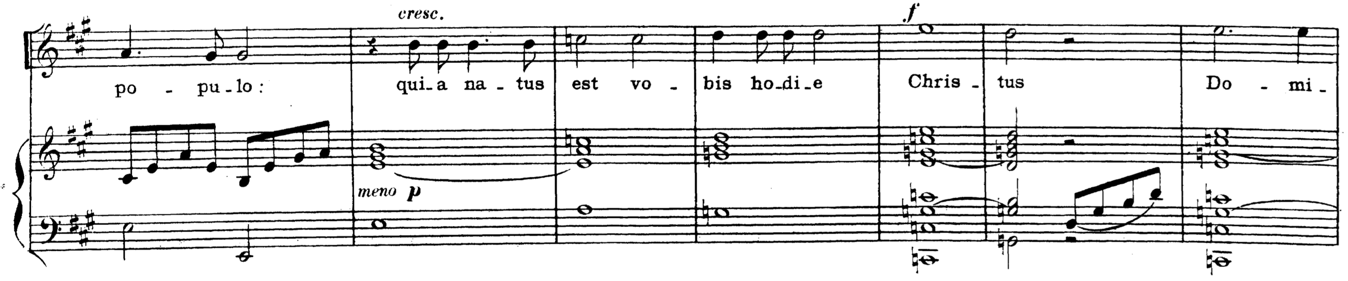 Übergang Sopran Arioso